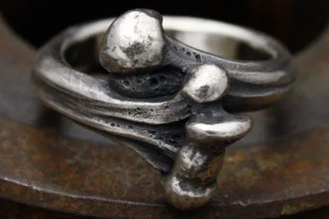 Humerus Ring